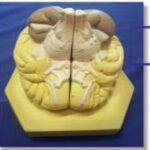 MODEL: BRAIN