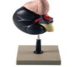 MODEL: KIDNEY